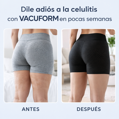 Masajeador Anticelulítico— Piel más firme y tonificada